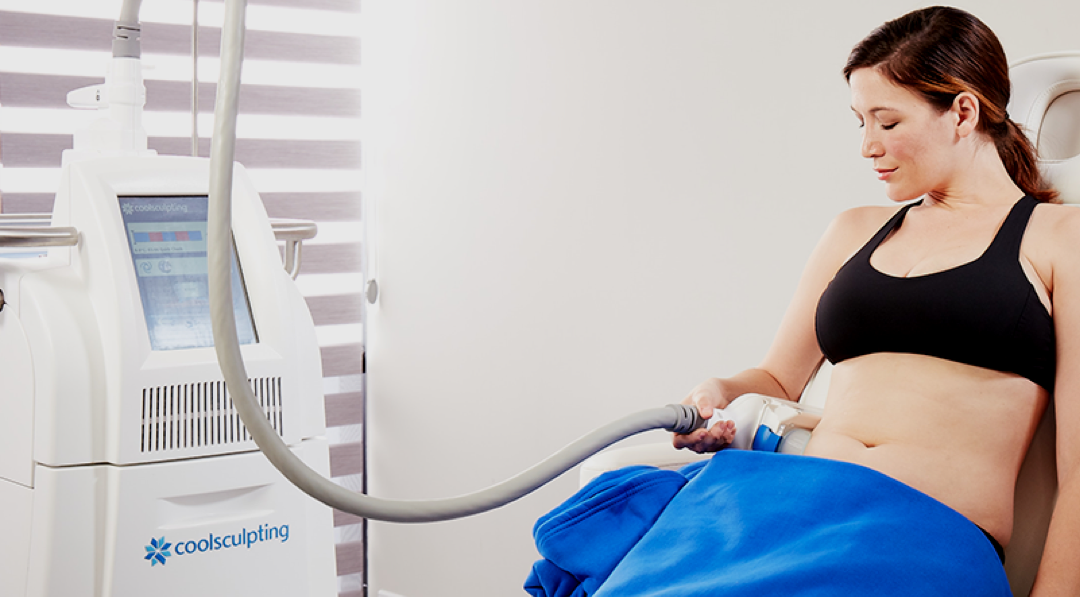 What to Expect: CoolSculpting in Vancouver